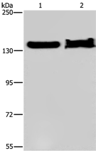 Anti-KDM4A antibody