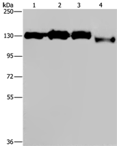 Anti-GTF2I antibody