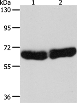 Anti-CYP1B1 antibody