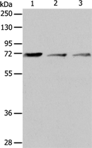 Anti-IL18RAP antibody