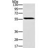 Anti-SLC29A4 antibody