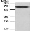 Anti-USP39 antibody