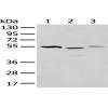Anti-NUDT12 antibody