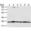 Anti-PSMB8 antibody