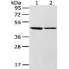 Anti-LTB4R2 antibody