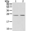 Anti-MIG7 antibody