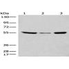 Anti-CCDC102B antibody