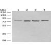 Anti-CLPTM1 antibody