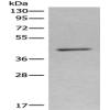 Anti-NR1I3 antibody