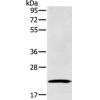 Anti-RAB39B antibody