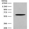 Anti-CORO2A antibody