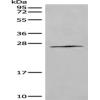 Anti-ANXA2R antibody