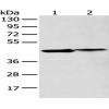 Anti-GDF11 antibody