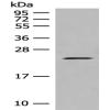 Anti-CDKN1A antibody