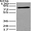 Anti-XPNPEP2 antibody