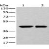 Anti-DLK1 antibody