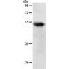 Anti-TNFRSF1B antibody