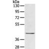 Anti-EGR3 antibody