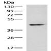 Anti-KCNK2 antibody