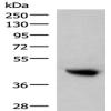 Anti-KIR2DL5A antibody