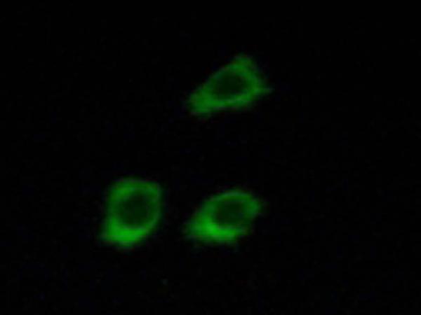 兔抗CLCN4多克隆抗体