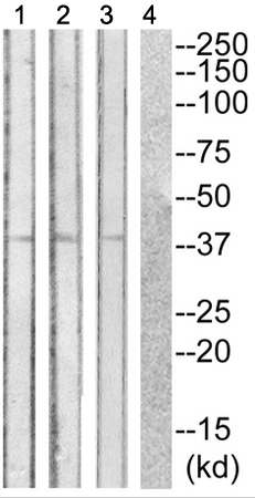 兔抗ANXA2(Phospho-Ser26)多克隆抗体