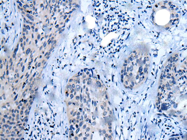 兔抗CLDN18多克隆抗体
