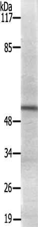 兔抗APLF(Ab-116)多克隆抗体