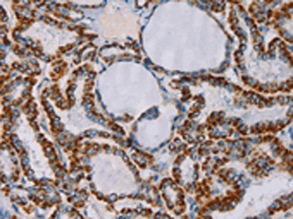 兔抗CMC4多克隆抗体