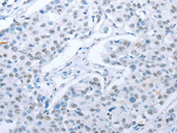 兔抗ARHGEF2多克隆抗体