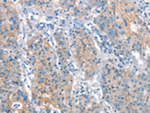 兔抗ARHGEF11多克隆抗体