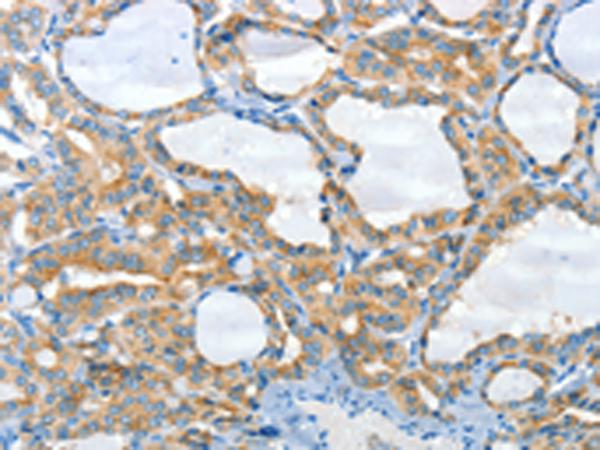 兔抗CNTNAP3多克隆抗体 