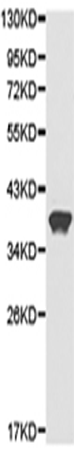 兔抗ARPC1A多克隆抗体