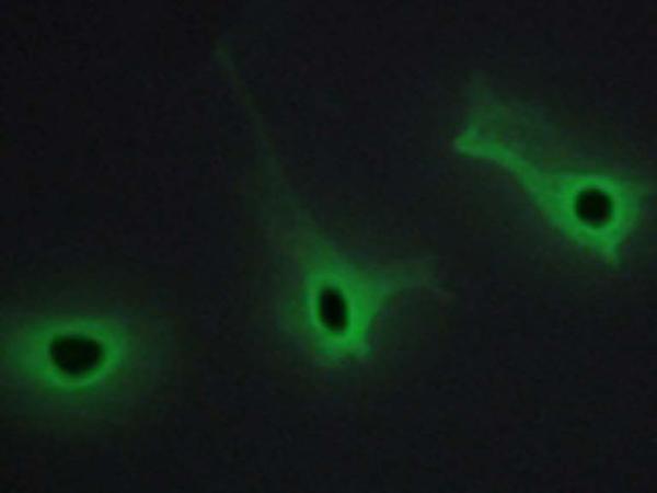 兔抗COL5A3多克隆抗体