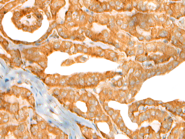兔抗CEP72多克隆抗体