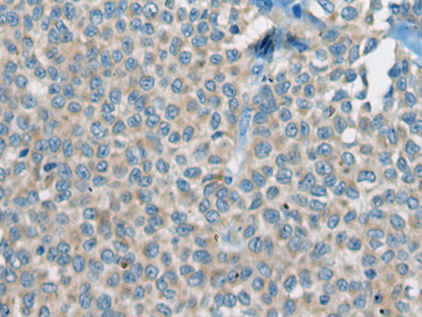 兔抗CEP170多克隆抗体