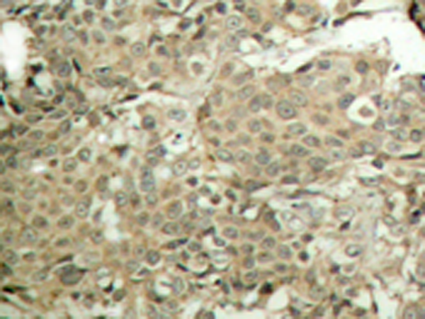 兔抗CFL1(Phospho-Ser3)多克隆抗体