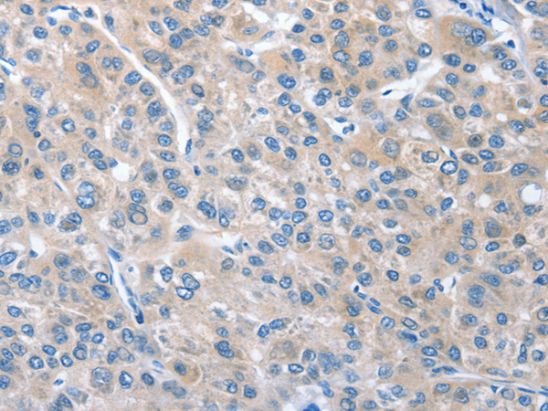 兔抗CGB3多克隆抗体