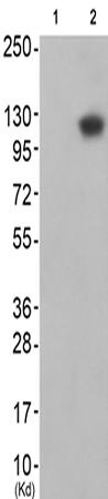 兔抗EPHA2/5(Ab-594)多克隆抗体