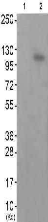 兔抗EPHA2/5(Phospho-Tyr594)多克隆抗体