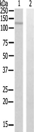 兔抗EPHB1多克隆抗体
