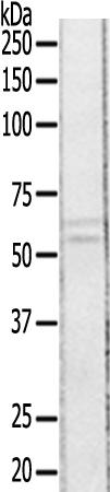 兔抗EPOR(Ab-426)多克隆抗体 