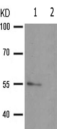 兔抗EPOR(Phospho-Tyr368)多克隆抗体
