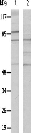 兔抗EPS8L1多克隆抗体