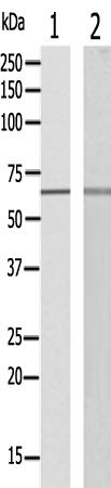 兔抗EPS8L3多克隆抗体