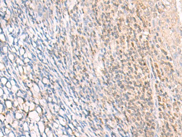 兔抗EPSTI1多克隆抗体
