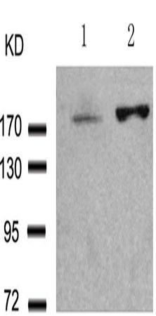 兔抗ERBB2(Phospho-Tyr877)多克隆抗体
