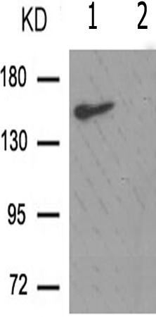 兔抗ERBB2(Phospho-Tyr1112)多克隆抗体 