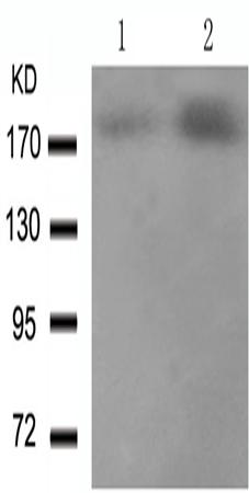 兔抗ERBB2(Phospho-Tyr1221/Tyr1222)多克隆抗体