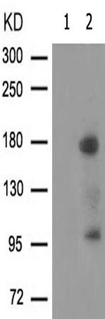 兔抗ERBB4(Phospho-Tyr1284)多克隆抗体